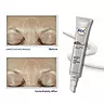 Bộ Sản Phẩm RoC Derm Correxion Dual Eye Cream & Fill + Treat Serum 